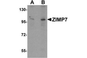 Western blot analysis of ZIMP7 in A20 cell lysate with ZIMP7 antibody at (A) 0. (ZMIZ2 Antikörper  (Center))