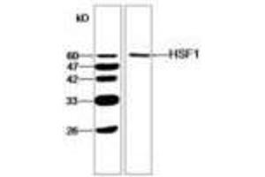 Image no. 1 for anti-Heat Shock Factor Protein 1 (HSF1) antibody (ABIN791450) (HSF1 Antikörper)