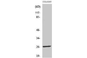 Western Blotting (WB) image for anti-Leucine Zipper, Down-Regulated in Cancer 1-Like (LDOC1L) (Internal Region) antibody (ABIN3175833) (LDOC1L Antikörper  (Internal Region))