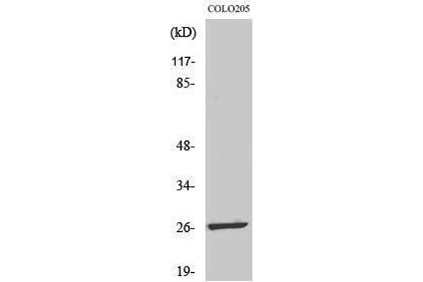 LDOC1L Antikörper  (Internal Region)