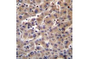 Immunohistochemistry analysis in formalin fixed and paraffin embedded human liver tissue reacted with Beta-glucuronidase Antibody (C-term) followed by peroxidase conjugation of the secondary antibody and DAB staining. (Glucuronidase beta Antikörper  (C-Term))