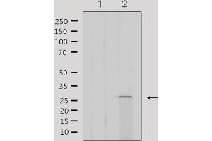 Western blot analysis of extracts from 293, using MRPL16 Antibody. (MRPL16 Antikörper  (Internal Region))