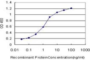 Detection limit for recombinant GST tagged PRL is approximately 0. (Prolactin Antikörper  (AA 29-227))
