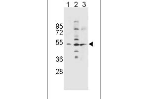 SLC36A1 Antibody (N-term) (ABIN656104 and ABIN2845446) western blot analysis in NCI-(lane 1),K562(lane 2),A549(lane 3) cell line lysates (35 μg/lane). (SLC36A1 Antikörper  (N-Term))