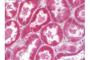 anti-Aldehyde Dehydrogenase 3 Family, Member A2 (ALDH3A2) (AA 166-400) antibody