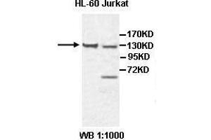 Western blot analysis of HL-60 and Jurkat cell lysate, using CHL1 antibody. (CHL1 Antikörper  (AA 788-1025))