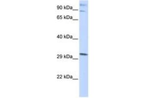 Image no. 1 for anti-Zinc Finger Protein 148 (ZNF148) (AA 684-733) antibody (ABIN6742483)