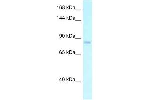 WB Suggested Anti-EMR2 Antibody Titration: 1. (EMR2 Antikörper  (N-Term))