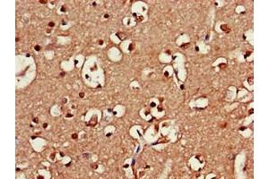 Immunohistochemistry of paraffin-embedded human brain tissue using ABIN7168941 at dilution of 1:100 (SRR Antikörper  (AA 1-340))