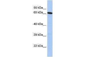 Host: Rabbit Target Name: GALNT15 Sample Type: PANC1 Whole Cell lysates Antibody Dilution: 1. (GALNT14 Antikörper  (N-Term))