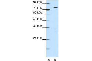 WB Suggested Anti-MYST2 Antibody Titration:  0. (MYST2 Antikörper  (N-Term))
