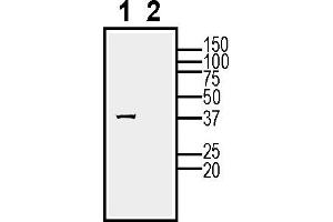 Western blot analysis of mouse kidney lysates:1.