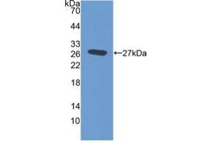 Western blot analysis of the recombinant protein. (EMILIN2 Antikörper  (AA 853-1074))