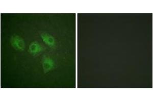 Immunofluorescence analysis of HeLa cells, using PI3-kinase p85-alpha (Ab-607) Antibody.