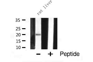 Western blot analysis of JM4 expression in Rat liver lysate (PRAF2 Antikörper  (C-Term))