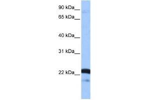 SFRS9 antibody used at 1 ug/ml to detect target protein. (SFRS9 Antikörper  (Middle Region))
