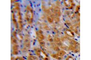IHC-P analysis of Kidney tissue, with DAB staining. (IL1RL1 Antikörper  (AA 162-349))