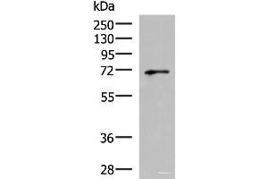 Western blot analysis of PC3 cell lysate using GSPT2 Polyclonal Antibody at dilution of 1:600
