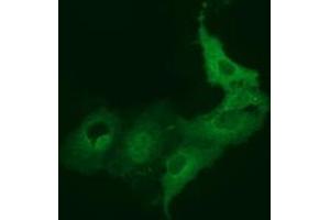 Anti-BEST3 mouse monoclonal antibody (ABIN2452805) immunofluorescent staining of COS7 cells transiently transfected by pCMV6-ENTRY BEST3 (RC218436). (Bestrophin 3 Antikörper)