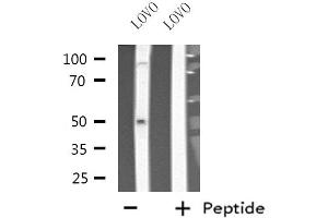 Western blot analysis of extracts from LOVO cells, using Cytochrome P450 3A7 antibody. (CYP3A7 Antikörper)
