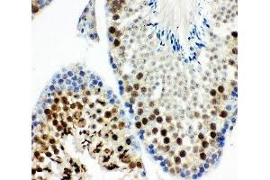 IHC-P: MCAK antibody testing of mouse testis tissue (KIF2C Antikörper  (AA 531-725))