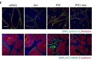 Immunofluorescence (Paraffin-embedded Sections) (IF (p)) image for anti-Periostin (POSTN) (C-Term) antibody (ABIN2854805)