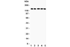 Western blot testing of Collagen Type 2 antibody and Lane 1:  COLO320;  2: HeLa;  3: MCF-7;  4: A549;  5: Jurkat lysate. (COL2A1 Antikörper  (C-Term))