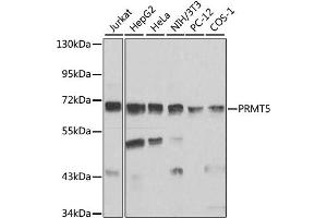 Western blot analysis of extracts of various cell lines, using PRMT5 antibody. (PRMT5 Antikörper)
