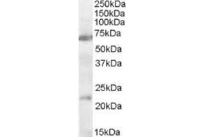 ABIN334375 (0. (CHRNA4 Antikörper  (AA 29-43))