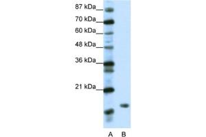 Western Blotting (WB) image for anti-TATA-Binding Protein-Associated Phosphoprotein (DR1) antibody (ABIN2461641)