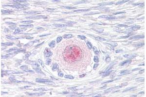 Anti-TM9SF4 antibody  ABIN1049415 IHC staining of human, ovary.