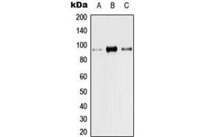 Western blot analysis of TRPV1 expression in Hela (A), Raw264. (TRPV1 Antikörper  (N-Term))