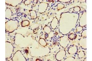 Immunohistochemistry of paraffin-embedded human thyroid tissue using ABIN7146571 at dilution of 1:100 (Calreticulin Antikörper  (AA 18-417))