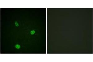 Immunofluorescence (IF) image for anti-Microphthalmia-Associated Transcription Factor (MITF) (AA 151-200) antibody (ABIN2888676) (MITF Antikörper  (AA 151-200))