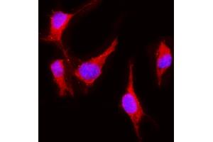 IF analysis of VEGF Receptor 2 using anti-VEGF Receptor 2 antibody (ABIN5693262). (VEGFR2/CD309 Antikörper  (AA 20-244))