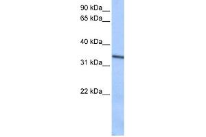 WB Suggested Anti-SEPT9(septin 9) Antibody Titration: 0. (Septin 9 Antikörper  (C-Term))