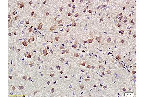 Formalin-fixed and paraffin embedded mouse brain labeled with Anti-SLC4A4 Polyclonal Antibody, Unconjugated (ABIN677498) at 1:400 followed by conjugation to the secondary antibody and DAB staining (kNBC (AA 1-100) Antikörper)