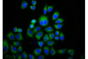 Immunofluorescence staining of Hela cells with ABIN7172863 at 1:133, counter-stained with DAPI. (TRPM3 Antikörper  (AA 1606-1713))
