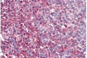 Human Tonsil (formalin-fixed, paraffin-embedded) stained with MAP2K1 antibody ABIN461964 at 10 ug/ml followed by biotinylated goat anti-rabbit IgG secondary antibody ABIN481713, alkaline phosphatase-streptavidin and chromogen. (MEK1 Antikörper  (N-Term))