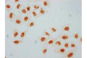 Immunocytochemistry (ICC) image for anti-Heat Shock Factor Protein 1 (HSF1) (pSer326) antibody (ABIN7127699)