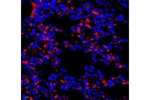 Immunofluorescence of paraffin embedded mouse lung using AMIGO2 (ABIN7072966) at dilution of 1: 1300 (400x lens) (AMIGO2 Antikörper)