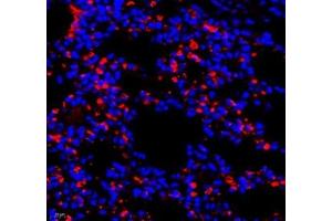Immunofluorescence of paraffin embedded mouse lung using AMIGO2 (ABIN7072966) at dilution of 1: 1300 (400x lens) (AMIGO2 Antikörper)