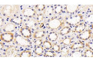 Detection of LAMP1 in Human Kidney Tissue using Polyclonal Antibody to Lysosomal Associated Membrane Protein 1 (LAMP1) (LAMP1 Antikörper  (AA 49-297))