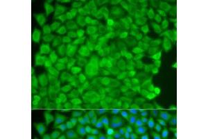 Immunofluorescence analysis of HeLa cells using SGCE Polyclonal Antibody (SGCE Antikörper)