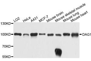 Western blot analysis of extracts of various cell lines, using DAG1 antibody. (Dystroglycan Antikörper  (AA 654-749))