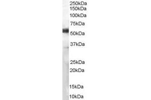 Western Blotting (WB) image for anti-Chromosome 13 Open Reading Frame 35 (C13ORF35) (C-Term) antibody (ABIN2791438) (C13orf35 Antikörper  (C-Term))