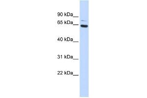 WB Suggested Anti-ZNF74 Antibody Titration:  0. (ZNF74 Antikörper  (Middle Region))