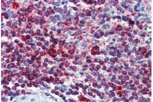 Human Spleen (formalin-fixed, paraffin-embedded) stained with HSPD1 antibody ABIN462364 followed by biotinylated anti-mouse IgG secondary antibody ABIN481714, alkaline phosphatase-streptavidin and chromogen. (HSPD1 Antikörper)