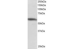 Western Blotting (WB) image for anti-Polypyrimidine Tract Binding Protein 2 (PTBP2) (N-Term) antibody (ABIN2466160) (PTBP2 Antikörper  (N-Term))
