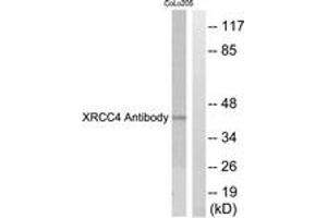 Western blot analysis of extracts from COLO205 cells, using XRCC4 Antibody. (DIRC2 Antikörper  (AA 261-310))
